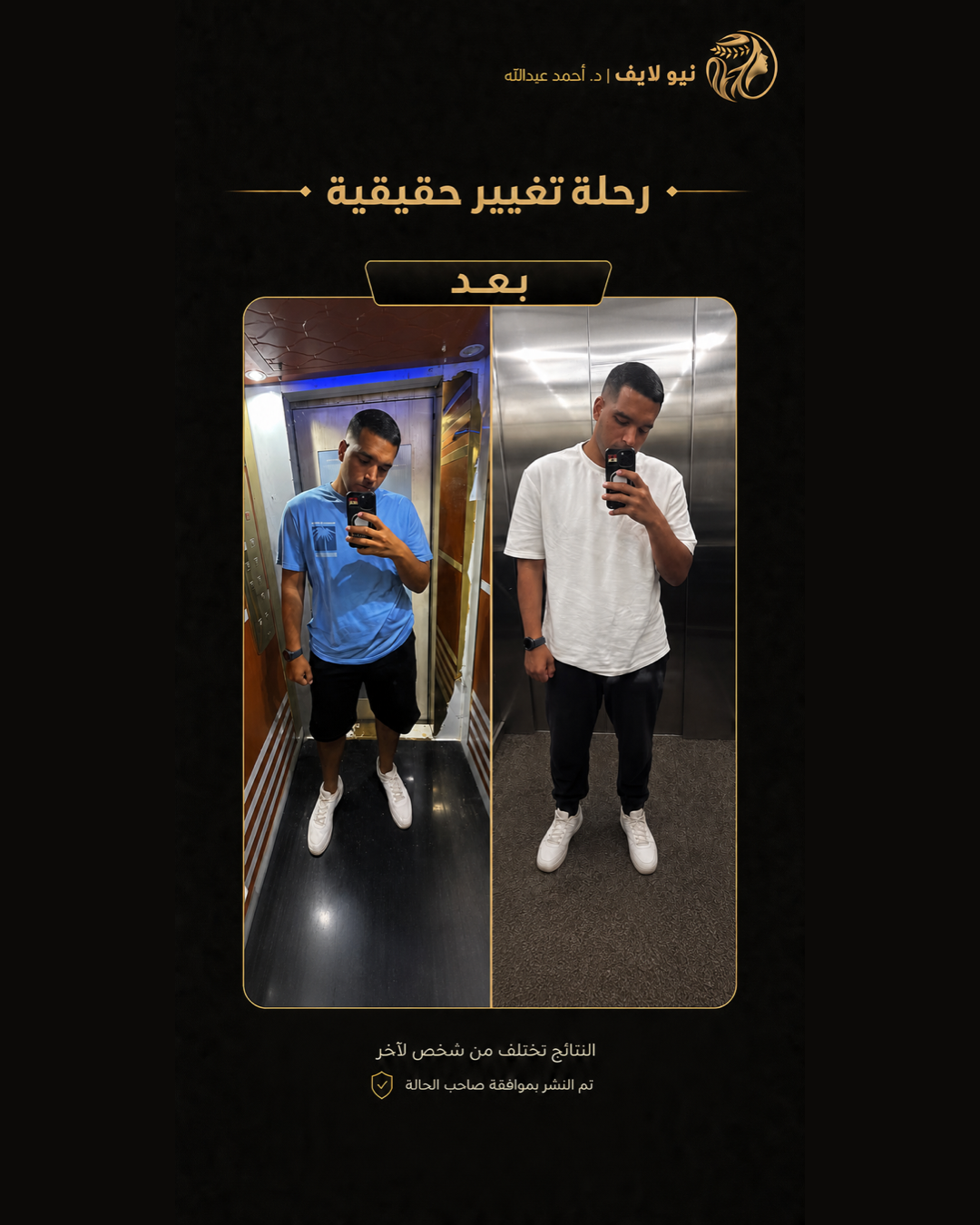 بعد